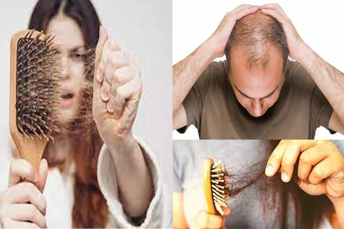 Hair Loss Medical Treatment Algonquin  Why We Have Hair Loss